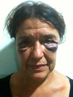 Carmen Rocer, una de las agredidas. Carmen Rocer, una de las agredidas.