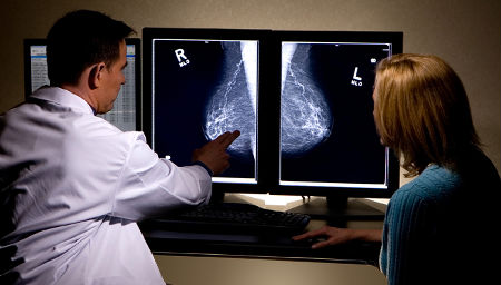 mammografía
