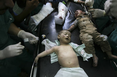 Niños palestinos atendidos este viernes en el hospital de Rafah