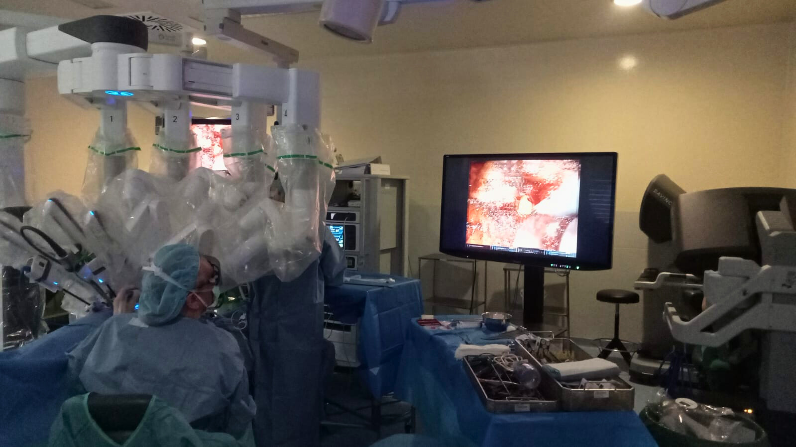 Cirujanos del Cunqueiro consiguen extirpar, por primera vez en el mundo, un tumor de próstata con una sola incisión