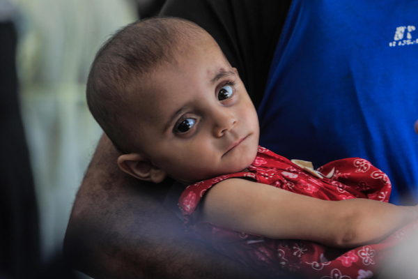 UNICEF alerta de que 12.800 niños da Gaza sufren "desnutrición aguda"