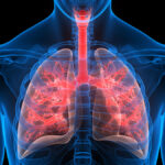 El Cunqueiro implantará un modelo integral de atención a pacientes con fibrosis quística