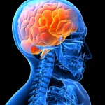Los neurólogos estallan contra Sanidad por vetar los nuevos medicamentos contra el alzhéimer en la sanidad pública